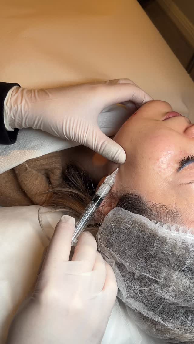 Spring is the perfect time to reset your skin and boost collagen from within ✨
After winter, your skin needs hydration, repair, and stimulation — not heavy treatments. That’s where regenerative aesthetics come in.
Our collagen-boosting treatments:
▫️ PDO Skin Booster — €390 (face)
▫️ Juvelook — €390 (face)
▫️ Karisma Collagen — €250 (face)
▫️ Polynucleotides — €195 (face)
These treatments work deep within the skin to:
• Improve texture and elasticity
• Restore hydration
• Stimulate natural collagen production
• Give you that healthy, natural glow
No overfilling. No artificial look. Just better skin.
Start now for glowing, stronger skin by summer 🌿
#polynucleotide #pdobooster #juvelook #karisma #collagen