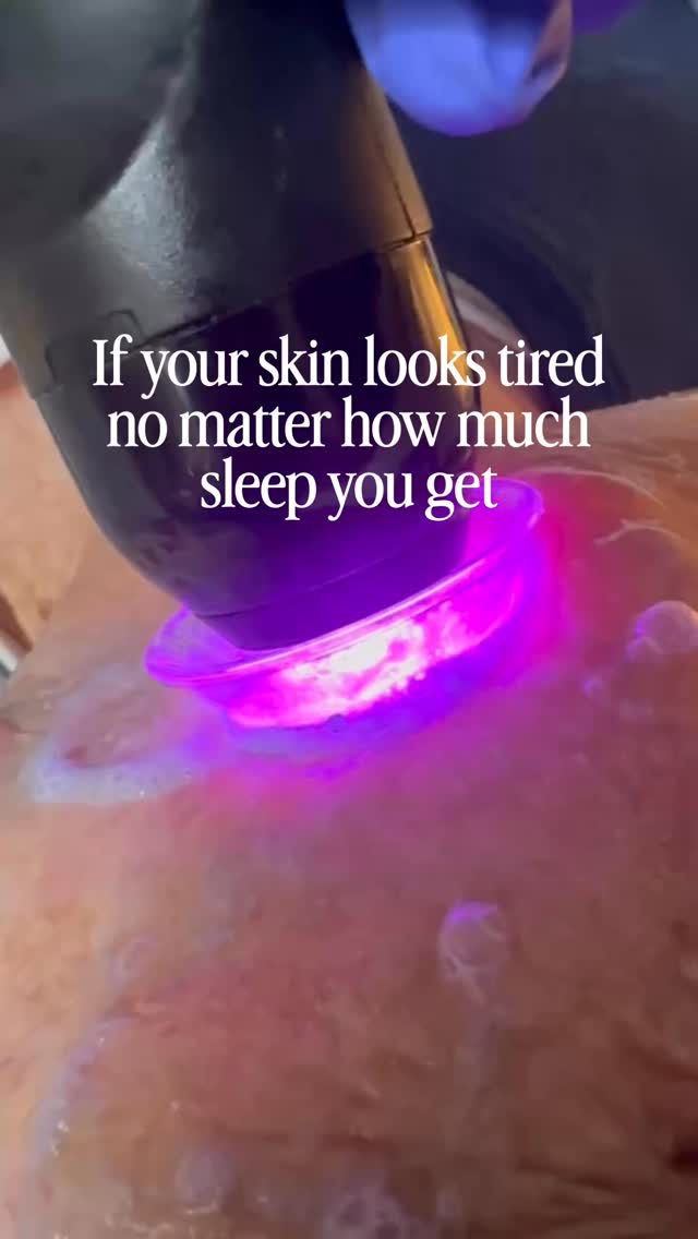 If your skin looks exhausted even when you’re not…
That’s not a sleep issue—it’s a circulation + oxygen issue 👀
Glo2 wakes your skin all the way up so you look as rested as you actually feel (or at least pretend to 😌)
Skip that next coffee, drink some water and schedule your next facial