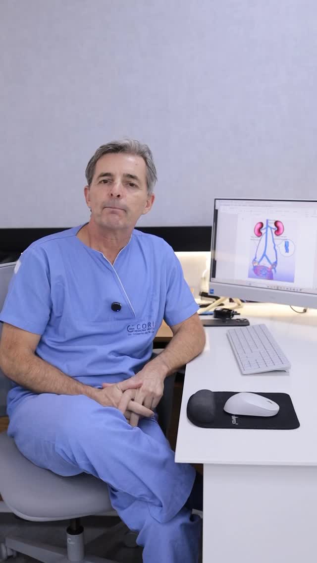 As varizes em membros inferiores estão entre as queixas mais frequentes no consultório vascular.
Mesmo após o tratamento, alguns pacientes podem notar o surgimento de novas varizes ao longo do tempo. Na maioria dos casos, não se trata de “retorno” das mesmas veias, mas sim do aparecimento de novas, especialmente em pessoas com predisposição.
Nessas situações, é importante investigar possíveis causas associadas. Uma delas é o refluxo pélvico.
Por isso, em casos de reaparecimento de varizes, principalmente mais calibrosas ou sem causa aparente, a investigação com ecodoppler vascular é fundamental para avaliar a circulação e orientar a conduta de forma individualizada.
Uma abordagem completa começa pela identificação da causa. É isso que direciona um tratamento mais preciso e com melhores resultados a longo prazo.