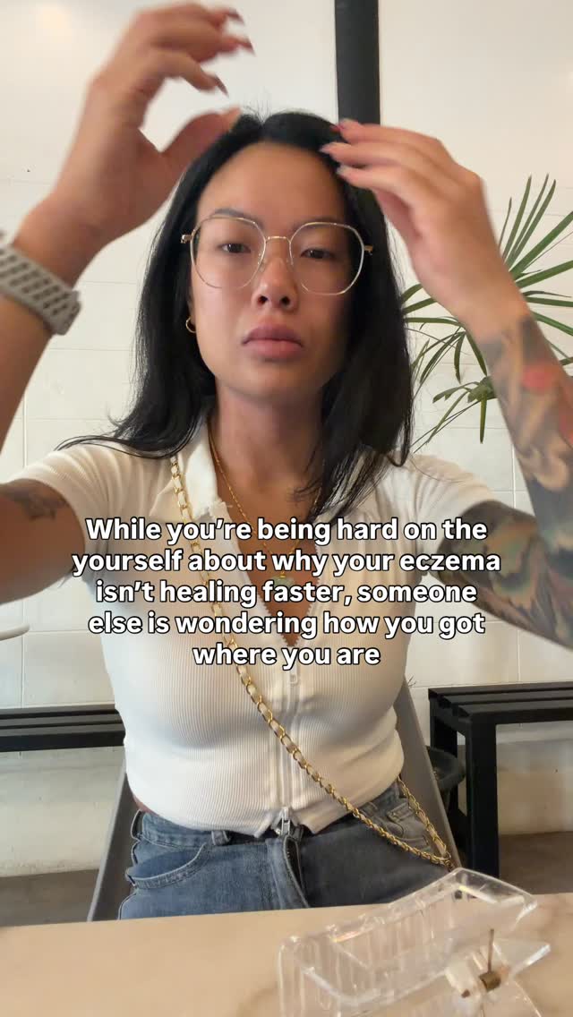 Don’t forget to celebrate every win and appreciate how far you’ve come.
There are days that are hard, but days that are better
When it comes to eczema healing, every day might seem the same and progress might seem insignificant.
But instead of comparing day to day, look at month to month or even where you were 6 months ago
Chances are you’re doing better than you think 💗
And if not, we’re always here to help our clients improve their symptoms as this is what we specialize in - getting to the root cause of eczema and helping you heal from within
🔗 Book a free consult at the link in our bio and we can talk about how we can support your journey!
#eczemahealing #eczematreatment #rootcausehealing #healingjourney