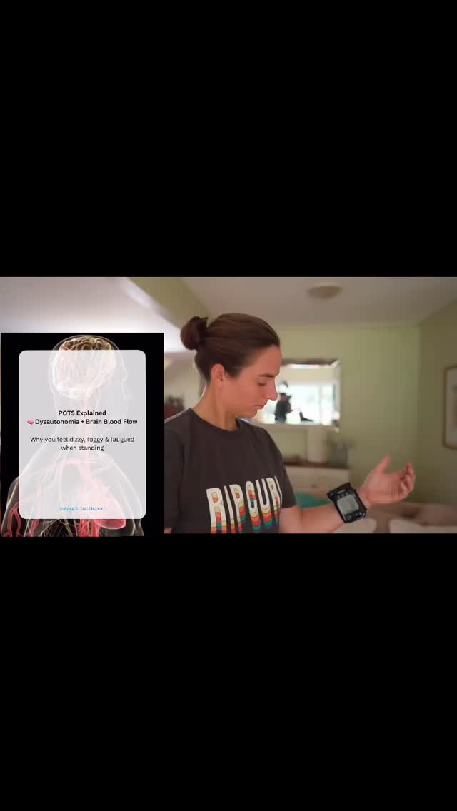 POTS isn’t just a heart rate issue — it’s a brain blood flow problem. 🧠
Postural Orthostatic Tachycardia Syndrome (POTS) is a form of dysautonomia, where the autonomic nervous system fails to properly regulate cardiovascular responses when you stand.
The result?
👉 Blood pools in the lower body
👉 Reduced venous return
👉 Compensatory increase in heart rate
👉 And in many cases… reduced cerebral blood flow
This phenomenon — cerebral hypoperfusion — helps explain why patients experience:
• Brain fog
• Dizziness
• Visual disturbances
• Fatigue
• Near syncope
Importantly, POTS is often triggered by real physiological events, including:
🦠 Viral illness (including COVID-19, EBV, influenza)
🧠 Concussion / traumatic brain injury
⚡ Autoimmune processes
💧 Hypovolemia
🧬 Connective tissue disorders
Diagnosis requires objective criteria, not just symptoms:
✔ ≥30 bpm HR increase within 10 minutes of standing
✔ Chronic symptoms (≥3 months)
✔ Absence of orthostatic hypotension
Testing (e.g., active stand or tilt table) is essential to confirm dysfunction and guide management.
💡 Clinically, POTS exists on a spectrum of autonomic dysfunction, often overlapping with:
• chronic fatigue syndromes
• post-concussion presentations
• vestibular disorders
📊 Key research insights:
• Many POTS patients demonstrate reduced cerebral blood flow when upright
• Up to ~50% may have small fiber neuropathy
• Strong links exist with post-viral and post-concussive states
• Increasing evidence supports neuroimmune involvement
🚨 If you experience persistent dizziness, fatigue, or brain fog — especially after illness or concussion — don’t ignore it.
It may be dysautonomia, not just deconditioning or anxiety.
#POTS #Dysautonomia #Concussion #BrainFog #Dizziness