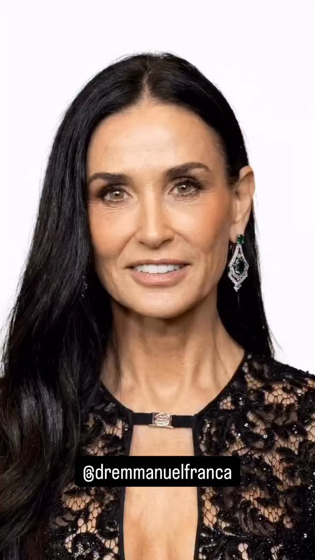 Ícones dos anos 80 🪩
Elas gerenciaram o envelhecimento e hoje estão assim. O que você acha?
Dr Emmanuel França
Dermatologista
CRM 5999
RQE 636