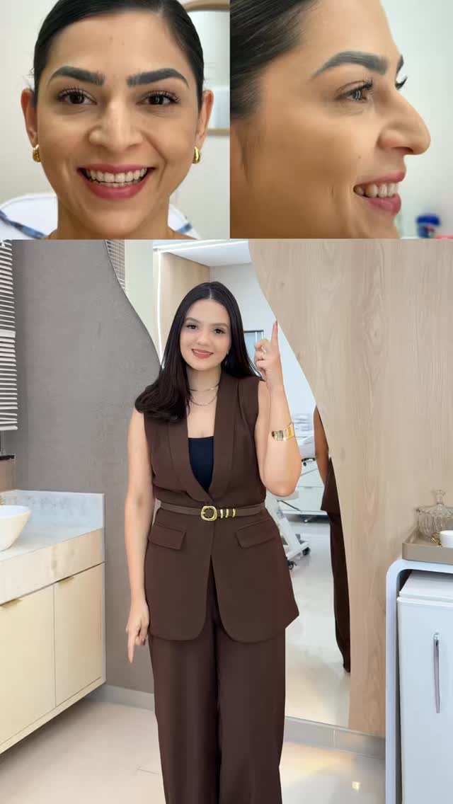 Problema X Solução ✅
Pra conhecer melhor os nossos serviços e como posso te ajudar a fiar mais linda ainda, entre em contato! O link está na Bio @dra.abigailsilva 🫶🏼
#estetica #botox