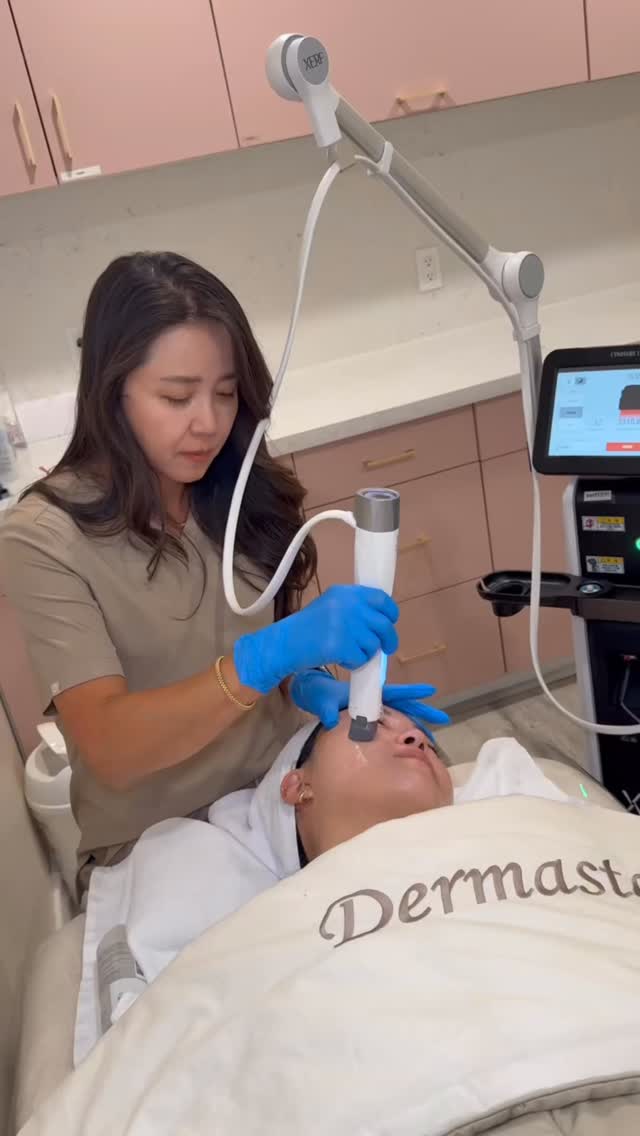 Looking for tighter, firmer skin?
XERF is a radiofrequency (RF) treatment designed to tighten and lift the skin by stimulating collagen production deep within. ✨
It helps improve overall skin firmness, smooth fine lines, and enhance skin texture all with minimal downtime.
✔️ Skin tightening
✔️ Lifting effect
✔️ Improves fine lines
✔️ Enhances skin texture
✔️ Minimal downtime
If you're starting to notice skin laxity or loss of firmness,
XERF can be a great option to support your skin goals. 👀
Experience XERF at Dermaster. ✨
DM us to book a consultation 💌
📍 3000 W Olympic Blvd #305, Los Angeles
📞 213-814-8410
#xerf #rftightening #skinlifting #facialtightening #firmerskin #youthfulskin #skintighteningtreatment #rfskin #noninvasivetreatment #aestheticclinic #medspatreatment #skinfirming #wrinklereduction #facialrejuvenation #beautytreatment #lamedsap #kbeauty #kimkardashian