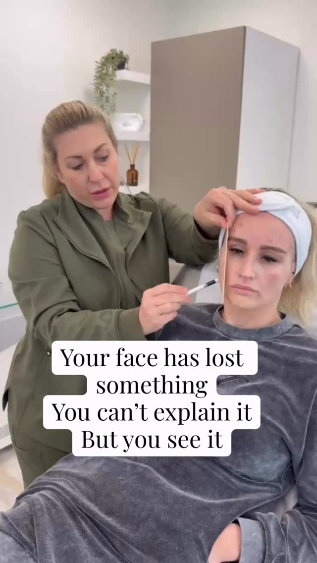 It’s not one line.
It’s the overall change.
Less fullness.
Less lift.
This is volume loss.
And it changes everything.
📩 DM “PLAN”
📧 hello@lifestyleyou.co.uk
📱 WhatsApp: 07843 841144
#volumeloss #facialageing #skinconfidence #aestheticclinicuk #naturalresults