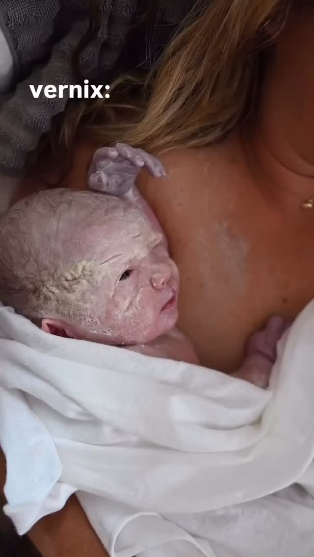 Vernix Caseosa (gorgeous video from @monetnicolebirths )
Have you heard of it? It’s the creamy white layer on your baby’s skin, just like in this photo. It is formed early in the womb and provides a barrier between your baby’s skin and the amniotic fluid.
At around 20 weeks of pregnancy your baby will be covered head to toe in a layer of vernix. From this point the thickness of the vernix will increase until its peak at around 36-38 weeks and if your baby is born at this time you will see it all over them.
From 36-38 weeks the vernix begins to soak in, until it’s just visible in the creases of their skin. If your baby is born after their due date their skin may even be a little bit dry as there is minimal vernix left.
Vernix isn’t just helpful during pregnancy. It has lots of benefits once they are born too. It makes your baby’s skin silky soft, helping to lock in moisture after birth if you slowly let it soak into the skin naturally. It also provides extra immunity and protection from germs, as it supports the development of your baby’s skins protective layer known as the ‘acid mantle’.
All of these amazing benefits are why it’s recommended to not wipe the vernix off after birth or wash your baby. You might think it looks a little gross, but the abundance of benefits might help you to resist and let this amazing, natural moisturiser slowly sink in and continue to nourish your baby’s skin.
Repost: @monetnicolebirths and I think it looks pretty cute too!