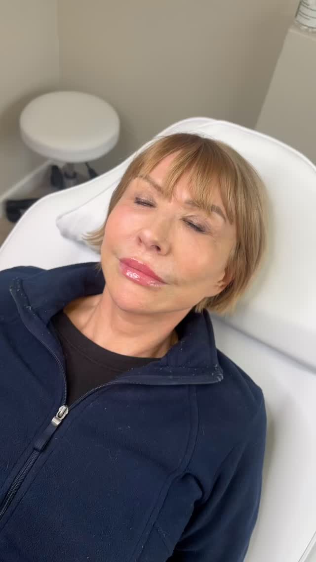 A subtle lip refresh 💉✨
Restored shape, improved symmetry and a soft, natural finish
𝐂𝐞𝐓𝐞 𝐀𝐞𝐬𝐭𝐡𝐞𝐭𝐢𝐜𝐬
👩🏽⚕️ 𝐑𝐞𝐠𝐢𝐬𝐭𝐞𝐫𝐞𝐝 𝐧𝐮𝐫𝐬𝐞
📧 𝐜𝐡𝐥𝐨𝐞@𝐜𝐞𝐭𝐞𝐚𝐞𝐬𝐭𝐡𝐞𝐭𝐢𝐜𝐬.𝐜𝐨.𝐮𝐤
📲 𝐰𝐰𝐰.𝐜𝐞𝐭𝐞𝐚𝐞𝐬𝐭𝐡𝐞𝐭𝐢𝐜𝐬.𝐜𝐨.𝐮𝐤
📍 𝟐𝟕𝟖 𝐀𝐬𝐡𝐛𝐲 𝐇𝐢𝐠𝐡 𝐒𝐭𝐫𝐞𝐞𝐭, 𝐃𝐍𝟏𝟔 𝟐𝐑𝐗, 𝐒𝐜𝐮𝐧𝐭𝐡𝐨𝐫𝐩𝐞
To schedule an appointment: Please send a DM or you can book directly via the link below ⬇️
www.ceteaesthetics.co.uk
-
#lipfillers #lincolnshireaesthetics #scunthorpe #scunthorpebusiness #nurse