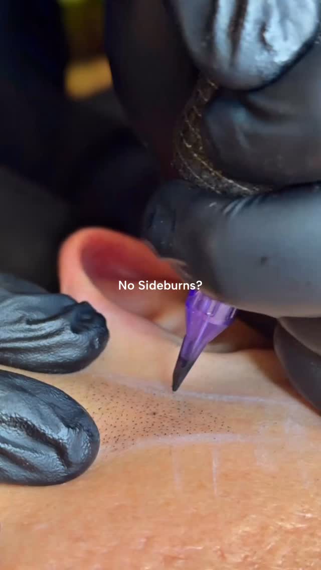 Sideburn hair loss can subtly throw off your entire facial balance. Even small gaps or thinning can make the hairline look uneven, especially when hair is tied back.
With Scalp Micropigmentation (SMP), we recreate natural looking density using ultra-fine pigments, following your original hair growth for a seamless blend.
At The KIMS Studio, we build results gradually for a soft, natural finish. Never harsh, never overdone.
✔ Restores shape and balance
✔ Fills sparse areas naturally
✔ No downtime
#hairloss #smp #scalpmicropigmentation #hairlosstreatment #hairline