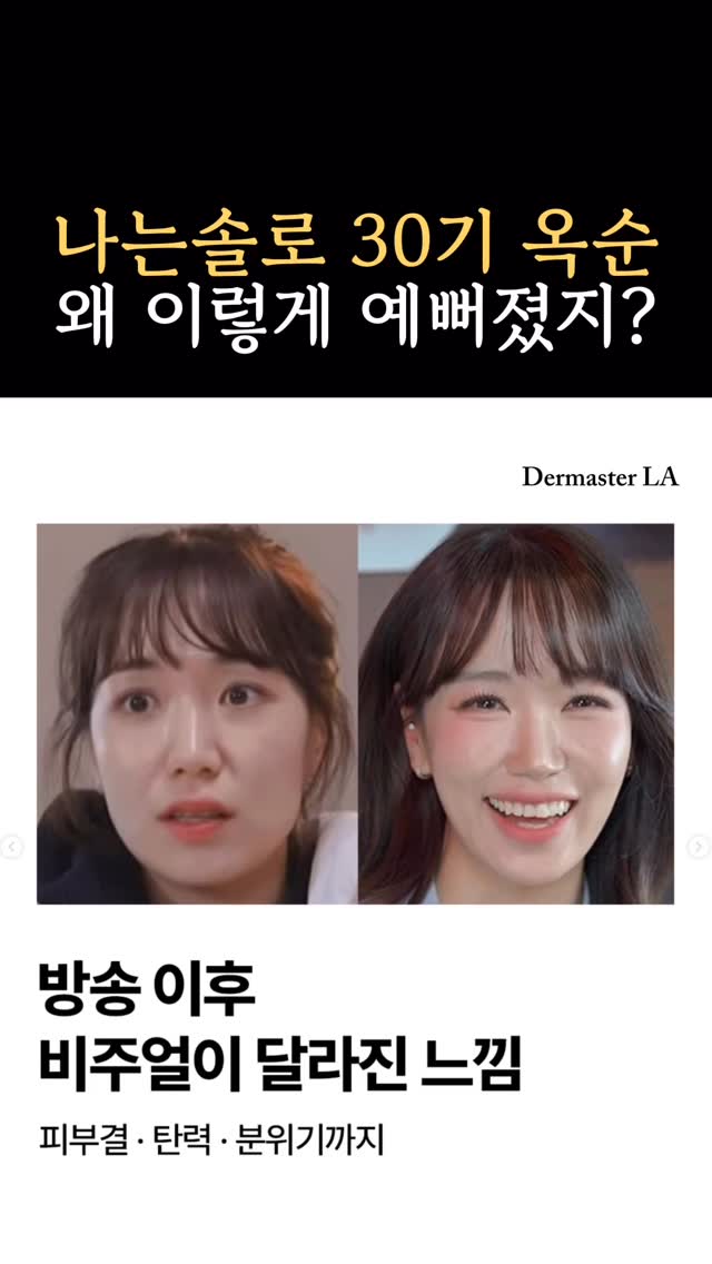 One of the hottest PCL skin boosters from Korea — Gouri ✨
Gouri helps stimulate collagen deep within the skin,
supporting firmer skin, natural volume, and a healthy glow 👀
The treatment involves little to no discomfort,
and downtime is minimal — usually just about a day of mild swelling that goes down quickly.
Recently gaining attention after being featured on a Korean reality show,
Gouri has become one of the most talked-about skin boosters right now ✨
A great time to try it while the promo is available 👍
If you're concerned about skin laxity, fine lines, or dull skin,
feel free to DM us for more information 💌
요즘 한국에서 핫하게 떠오른
PCL 스킨부스터, Gouri (고우리) ✨
피부 속 콜라겐 생성을 도와
탄력 개선 + 자연스러운 볼륨 + 윤기 있는 피부결까지 기대할 수 있는 시술이에요 👀
통증도 거의 없는 편이고,
다운타임도 하루 정도 붓기 후 빠르게 가라앉는 편이라
부담 없이 시작하기 좋은 스킨부스터로 많이 찾고 있어요 ✨
요즘 나는솔로30기 옥순님이 하신 시술이라고 알려지면서
더 많은 분들이 관심 갖고 있는 시술 중 하나입니다 👀
피부 탄력, 잔주름, 피부결 고민 있으신 분들
편하게 DM 주세요 💌
📍 3000 W Olympic Blvd #305, Los Angeles
📞 213-814-8410
#gouri #gouriskinbooster #pclskinbooster #skinbooster #koreanskin #kbeauty #glassskin #collagenboost #skinrejuvenation #antiaging #firmerskin #skinlifting #minimaldowntime #naturallookingresults #losangelesmedspa