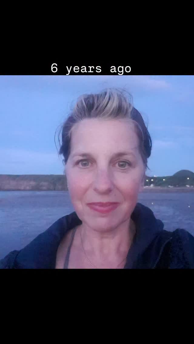 This video was 6 years ago
I've done my best to raise awareness.
Still no cure for #parkinsons
Despite improvement with #deepbrainstimulation my body is failing me.
I truly miss being able to talk without it exhausting me.
Sorry beyond sorry to @saltburnandy for keeping you awake with my nightmares.
Losing my sense of smell is the latest of a potential 40 plus symptoms to arrive.
It's a #shitshow
Grateful that im still independent and for the bits of me that still work!
