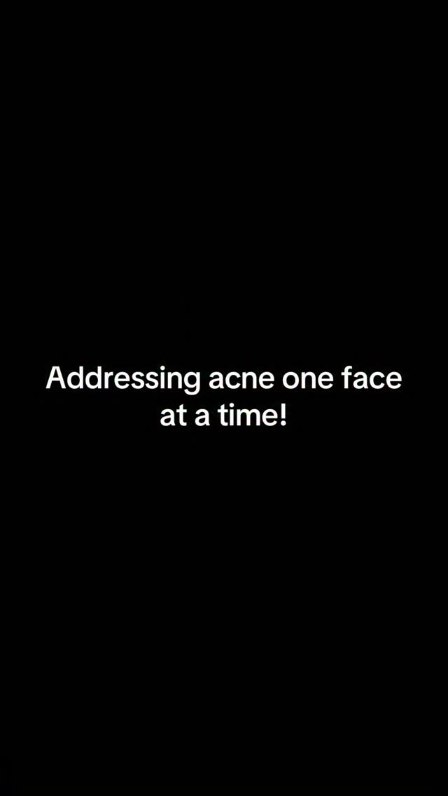 One face at time! Book your facial or acne consultation today!
#rockvillemd #frederickmd #acne #acnetreatment #acneproneskin