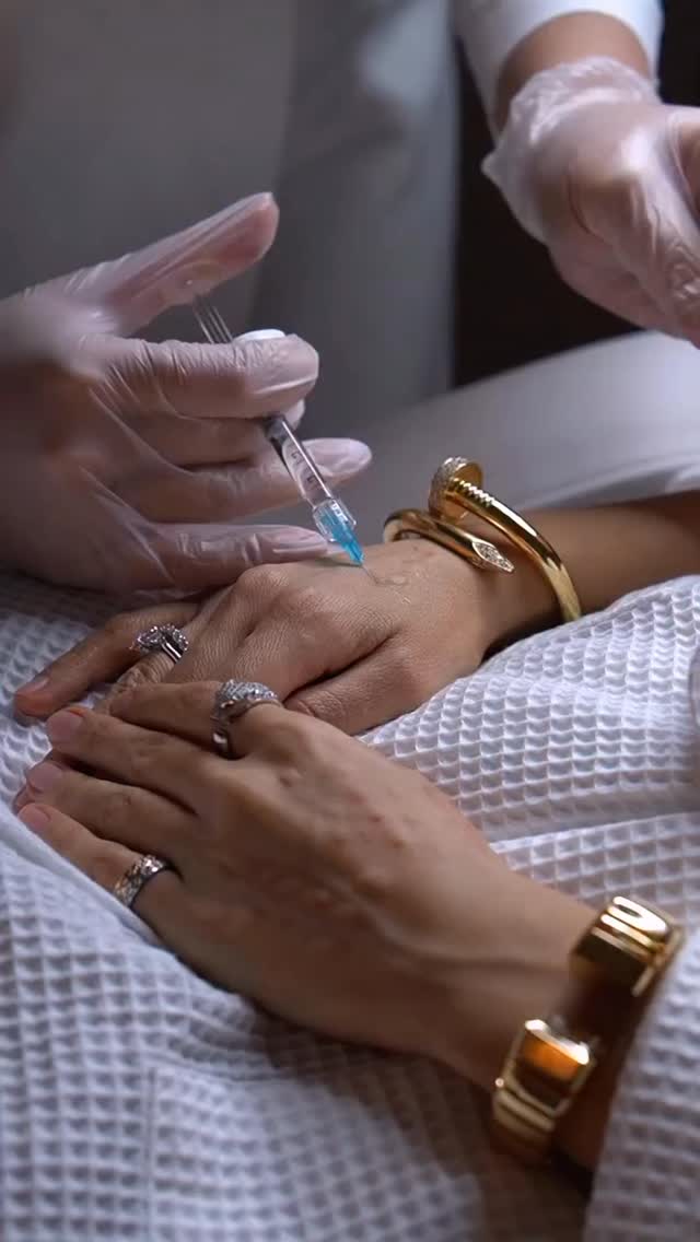 Do not forget about your hands ❤️ #athloneclinic #rejuvenation #hand #skin