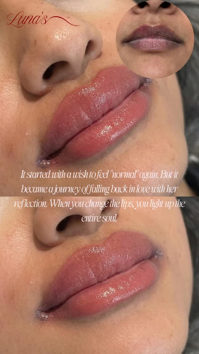 If your lips look purple or grey—no, you’re not alone. 🫦💭
It’s so common… but almost nobody talks about it.
Two-toned, cool, or patchy lips can make even the prettiest lipsticks look off, or vanish completely after a few sips of coffee.
You might have tried every “universally flattering” nude or the latest lip mask—only to end up feeling frustrated, still reaching for liner or hiding your smile in photos.
Here’s the truth: you’re not the problem. Most products just aren’t made for lips with deeper, uneven tones. But there is a better way.
✨ Dark Lip Corrective Art neutralizes those purple or brown hues in gentle, custom steps—revealing the healthy, wearable color you’ve always wanted, no matter your natural tone.
Ready to feel confident with nothing on your lips?
Send me a DM or drop a 💕 if you want to learn how the process works (and see real results!).
#DarkLipCorrection #LipNeutralization #RichmondHillBeauty #ConfidentSmile #InclusiveBeauty