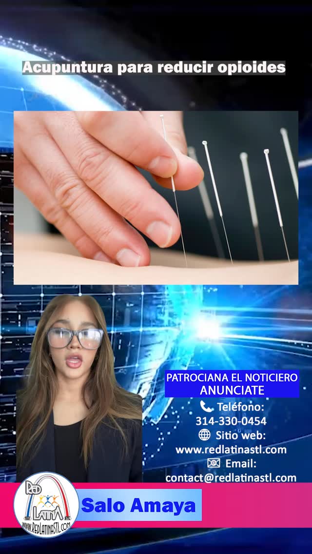 Surge como alternativa en cirugías para disminuir el uso de opioides, aunque enfrenta limitaciones regulatorias. Estudios muestran que puede disminuir el dolor postoperatorio y la dependencia a estos medicamentos. Sin embargo, regulaciones estatales limitan su aplicación. Expertos aseguran que modernizar estas leyes podría mejorar la salud pública y ofrecer opciones más seguras para millones de pacientes.
#StLouis #Noticias #Comunidad #Salud #Economia #Seguridad #Actualidad #EstadosUnidos #NoticiasLocales #RedLatinaSTL #RedLatinaInforma #SeguimosCreciendo #LatinNetwork