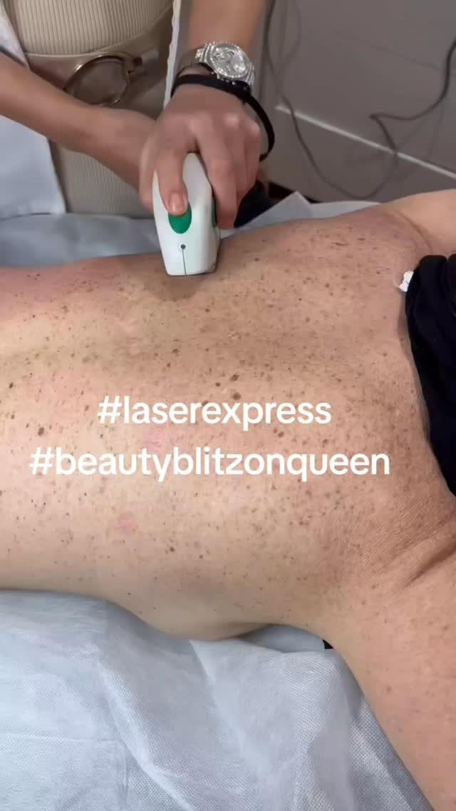 BBL, LASER & IPL PIGMENTATION REMOVAL - Renewed Confidence
Our BBL & Laser not only eliminates pigmentation and promotes cell rejuvenation, restoring your confidence in your skin’s health and appearance.
Say farewell to uneven, sun damaged , freckled skin as our treatment soothes and balances your skin, achieving clear and even complexion. Treatments are ideal for face and body.
Book online at www.laserexpress.com.au
.
.
#skinrenewal
#laserhairremoval
#skintherapist
#skincareexpertlogan
#laserexpressqld