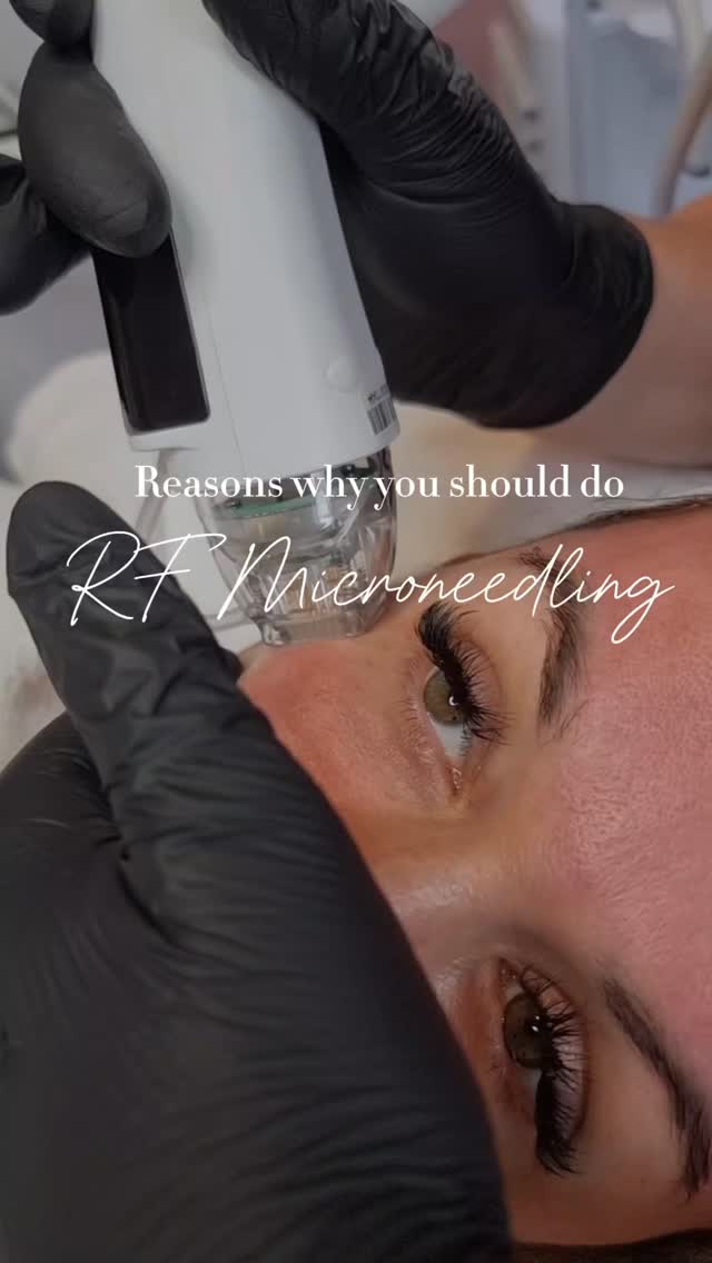 Book with Bryoney @revolutionbeautybryoney
How to Book?
📩Direct Message
☎️Call 01473 208082
📲WhatsApp +447367791686
🤳Online via link in our bio
📍210 Rosehill Road, IP3 8HG, Ipswich, Suffolk