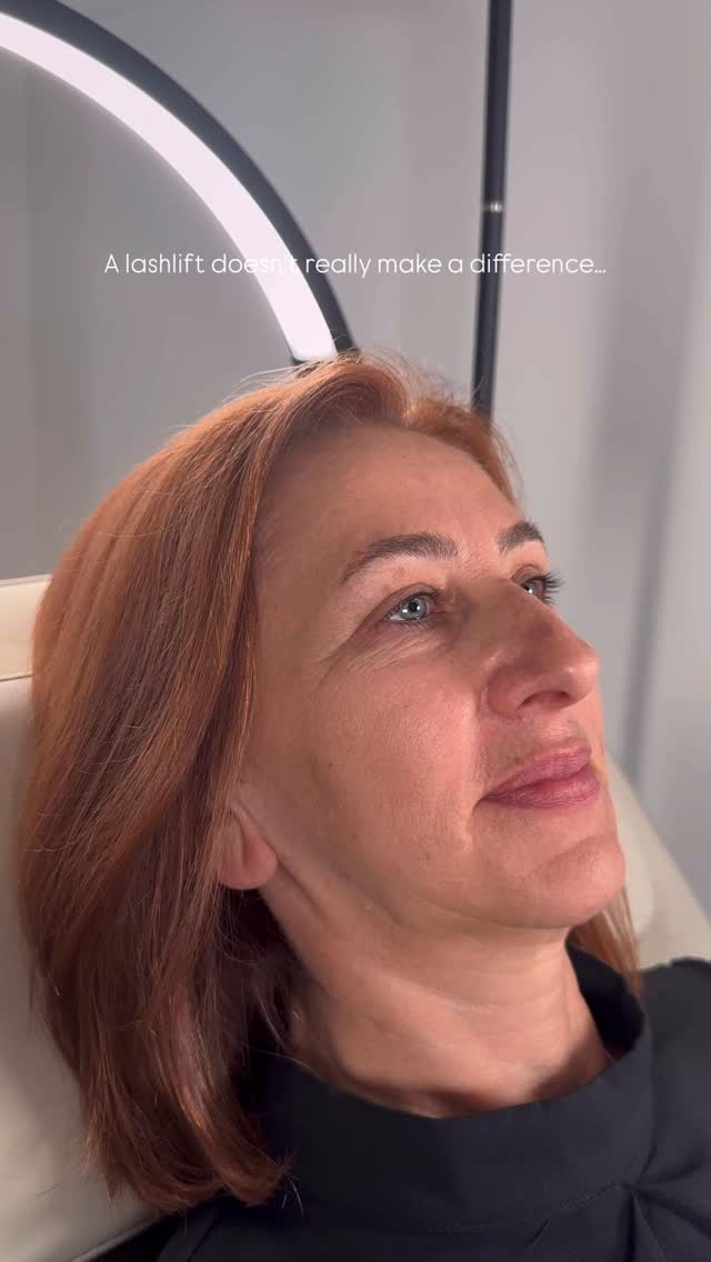A Lashlift makes the biggest difference 😮💨
Verabschiede dich von Mascara und einem ständig müden Blick - mit einem Lashlift bringst du deine Augen zum Strahlen und kannst bis zu 6 Wochen auf MakeUp verzichten 🤎
Buche noch heute deinen Termin 📲
www.novafacesmunich.vom
#lashlift #lashliftmünchen #browliftdeluxe #permanentmakeup #permanentmakeupmünchen