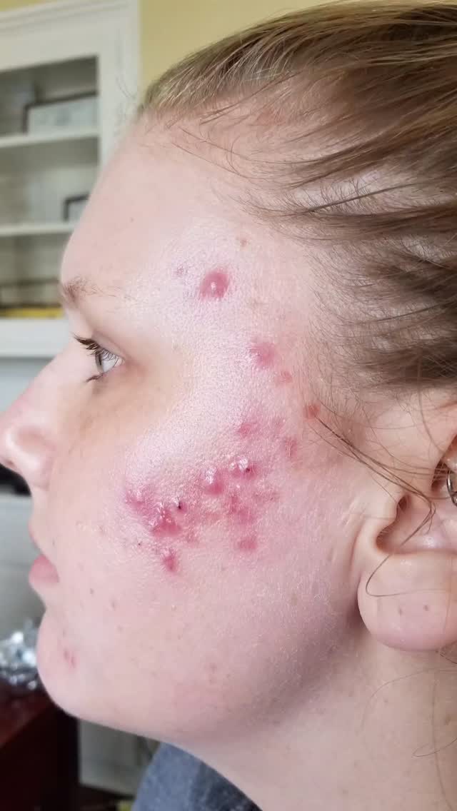 This story has a fairytale ending. 🧚♀️📖
Our skin changes through different phases in our life. I'm here to help you navigate all the changes. If it's been a while since you've been in and you could use some guidance I would love to help you. #skincarfairygodmother