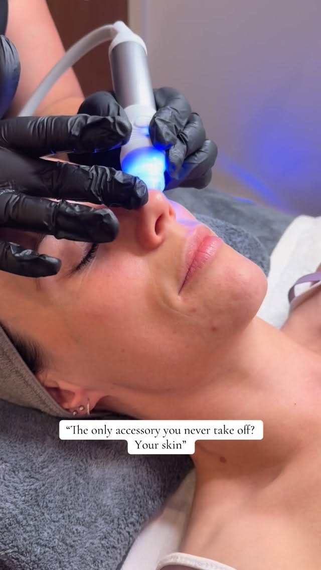 The NovaHydra Facial from Nova Pellis is an advanced, results-driven treatment designed to deeply cleanse, hydrate, and revitalise the skin in one luxurious session. Combining innovative skincare technology with targeted active ingredients, this facial works to restore balance, boost hydration, and leave your complexion visibly smoother and more radiant.
The treatment typically includes gentle exfoliation to remove dead skin cells, followed by intensive hydration using nourishing serums packed with skin-loving ingredients. This helps to improve skin texture, refine pores, and enhance overall glow without irritation or downtime.
Perfect for all skin types, the NovaHydra Facial is especially beneficial for those experiencing dryness, dullness, or tired-looking skin. It delivers an instant refresh, making your skin feel plumper, softer, and more luminous.
One of the standout benefits is how beautifully your skin looks afterwards—hydrated, smooth, and prepped perfectly for makeup application. Foundation applies more evenly and lasts longer, giving you that effortless, healthy-skin finish.
Whether you’re preparing for a special occasion or simply want to maintain a glowing complexion, the NovaHydra Facial is a go-to treatment for achieving fresh, hydrated, and radiant skin.