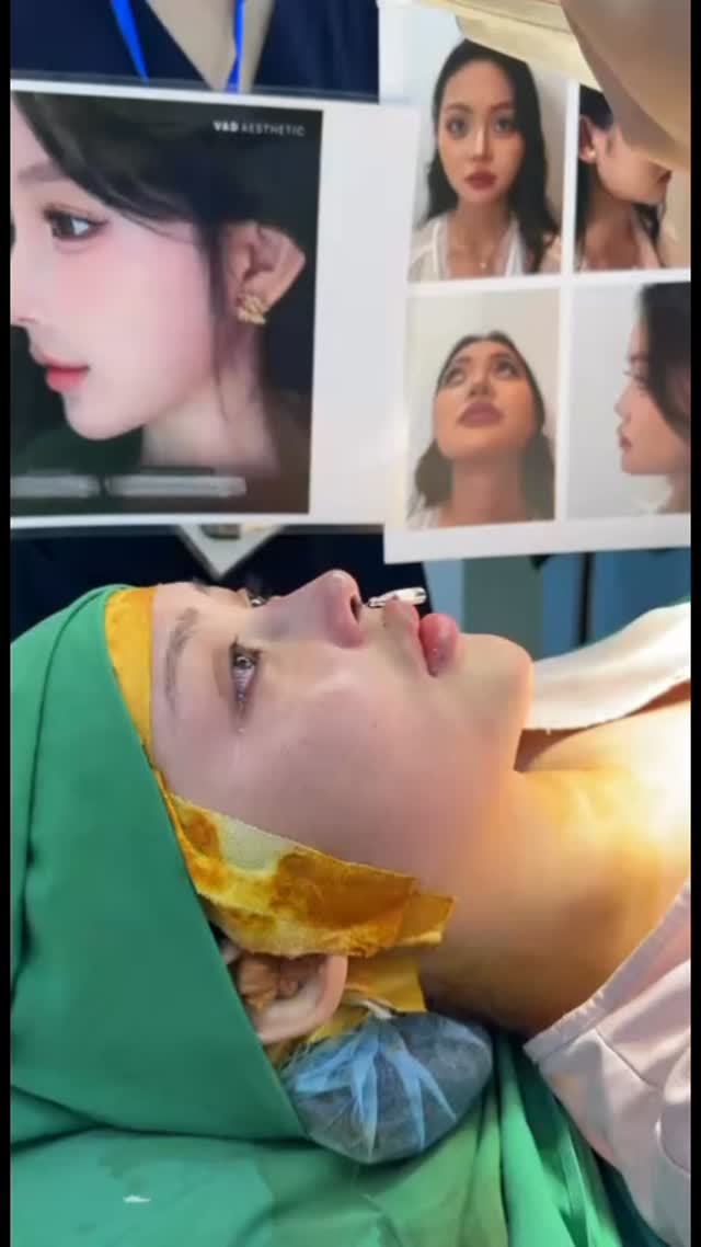 Baby doll shape nose . Shanghai skill
#