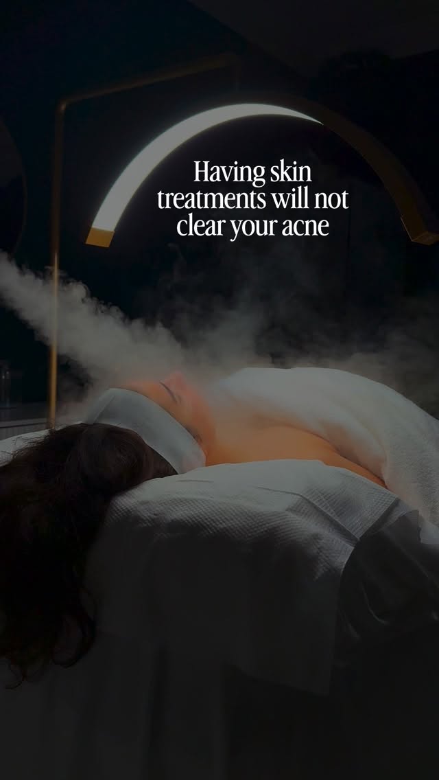 Having skin treatments alone will not clear your acne 👀
And I think this is where so many people get frustrated.
Because acne is not just about what you put ON the skin - it’s about what’s happening inside the body too 🧬
You can have the most advanced treatments in the world, but if your gut health is compromised, your stress levels are chronically high, your nervous system is dysregulated, your sleep is poor and your routine is inconsistent, your skin will continue to struggle 😓
Acne is a chronic inflammatory condition.
It needs more than random facials and hoping for the best.
This is why I focus so heavily on the FULL picture as an acne specialist ✨
Clinical treatments matter.
Medical-grade skincare matters.
But so does:
• barrier health
• nervous system regulation
• diet and blood sugar balance
• sleep quality
• reducing internal inflammation
• gut support
• hormonal health
• consistency with your homecare routine
Because consistency is where results are built 🤍
Not doing your skincare for 3 days then stopping 👀
Not using active products once a week and expecting transformation 🫢
Not jumping from trend to trend every month because TikTok told you to 😬
Clear skin comes from following the RIGHT plan consistently long enough for the skin to actually heal ❤️🩹
That’s why my clients get long-term results wether they see me in clinic or not - because we focus on the root cause, support the skin properly and stay consistent through the process 🌿
Do you not know where to start?
DM me the word “ACNE” and I’ll send you my brand new FREE e-book:
“Why Your Acne Isn’t Clearing (And What You’re Missing)” 🩷