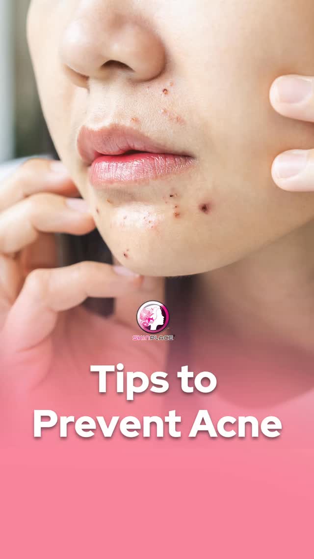 ✨ Your Guide to a Clearer Complexion
Consistency is the secret to a healthy-looking glow! Try these simple steps to keep your skin balanced and radiant:
Be Gentle: Avoid picking at spots to prevent irritation and scarring. 🚫
Daily Cleanse: Wash twice a day with a mild cleanser to keep pores clear. 🧼
Tone & Mask: Use a toner for oil control and a weekly mask for a deep refresh. 🧖♀️
Targeted Care: Use active ingredients like Salicylic Acid for occasional blemishes.
Eat Well: Support your skin from the inside with a balanced, nutrient-rich diet. 🍏
Expert Advice: Get a routine tailored just for you!
Ready for professional results? Visit Skin Place Clinic for expert care designed for your unique skin goals. 🏥✨
#SkinCare #HealthySkin #GlowUp #SkinPlaceClinic #SkincareRoutine