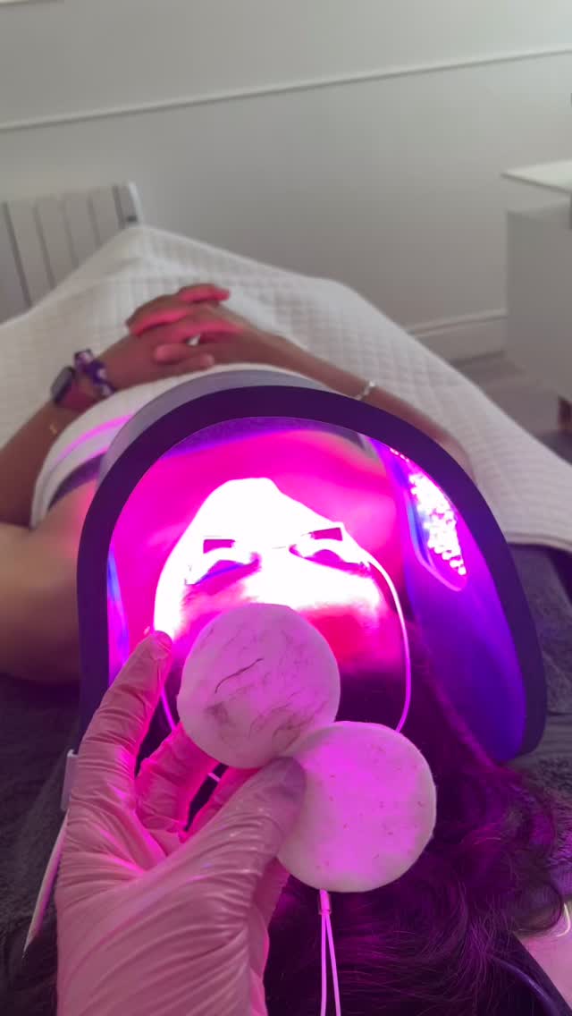 LED light therapy benefits:
• Boosts collagen (helps smooth fine lines)
• Clears acne-causing bacteria
• Reduces redness & inflammation
• Speeds up skin healing
• Gives an overall glow ✨ #aestheticsbyam #oxfordsalon #oxford #oxfordaestheticclinic