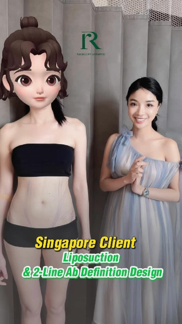Combo Tummy Liposuction + waist + love handles at 5-star international hospital
#plasticsurgery #liposuccion #fatremoval #lipo360
