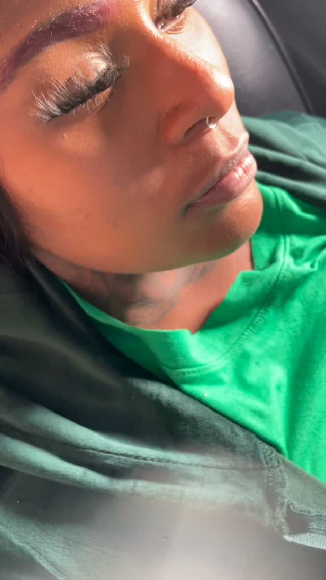 Come lay where you get slayedddd ๐๐ค๐พ๐ค๐พ #tampalips #stepetelipfiller #lipfiller #facialbalancing #microinjection
