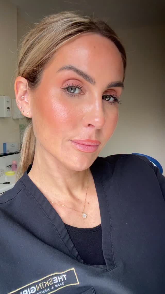 Regenerative aesthetics ALL THE WAY
Let’s talk polynucleotides!!!
I have never used so many of these products before, I’m getting incredible results for both myself and my clients ⬇️
I dissolved all my filler… and honestly, my skin has never looked better
Over the last few years, aesthetics has shifted massively from “adding volume” to improving actual skin health — and polynucleotides have become one of my favourite regenerative treatments.
Unlike filler, polynucleotides don’t volumise the face. They work by stimulating fibroblasts, supporting collagen production, improving hydration, calming inflammation and helping repair the skin from within.
The result?
Healthier skin.
Better texture
More glow
Improved elasticity
Fresher & more natural results
One thing I hear all the time is:“Do they last for years?”
The product itself doesn’t physically stay in the skin for years — but the collagen stimulation and skin quality improvements can absolutely be long-term with maintenance treatments.
For me personally focusing on regenerative treatments like polynucleotides, skin tightening and collagen stimulation has completely changed my approach to aesthetics