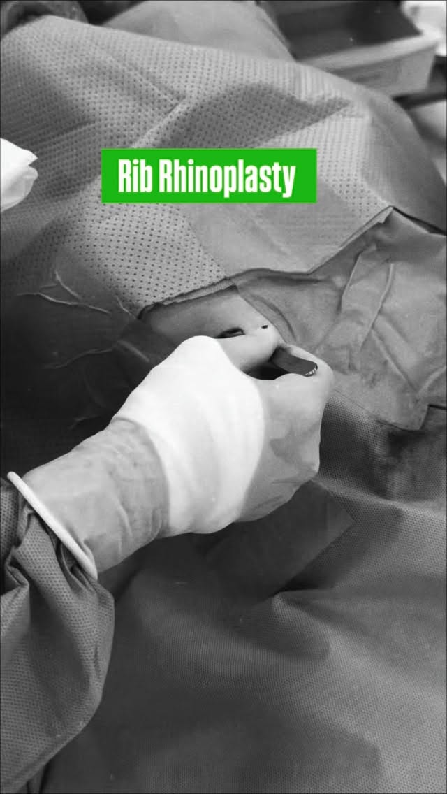Rib Rhinoplasty
Vietnam Clinic
R&R Beauty Aesthetic / R&R Beauty Clinic
📍 10A Truc Duong, An Khanh Ward, Ho Chi Minh City, Vietnam
Singapore Studio
R&R Beauty Studio
📍 416 Ang Mo Kio Ave 10, #01-985, Singapore 560416
#rhinoplastybeforeandafter #rhinoplastik #ribrhinoplasty