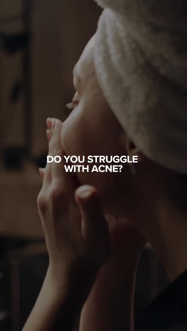 Still breaking out? It might be your products 👀
These acne-triggering ingredients could be the reason your skin isn’t clearing:
Pore-clogging oils, heavy silicones, certain alcohols, and hidden fragrances.
Clear skin isn’t just about what you use—it’s about what you avoid ✨
Save this before your next skincare purchase 💫
📍Beauty Queens Aesthetics & Wellness Medicine
1776 Princess Anne Rd
Virginia Beach, VA 23456
☎️757-876-9136
🌐 www.beautyqueensvb.com
.
.
.
.
#757medspa #acnetriggers #acnetreatment #clearskintips #virginiabeachva