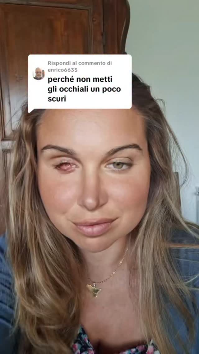 #occhi #cancersurvivor