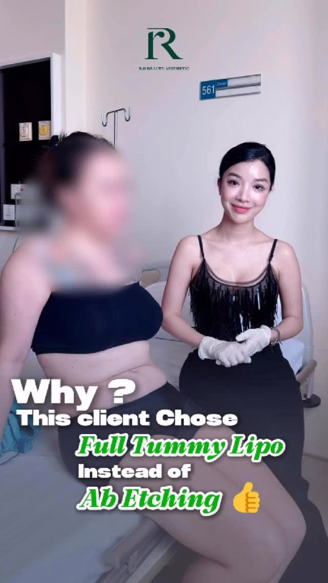 Customer Singapore do combo Tummy + waist lipo
Vietnam Medical Tourism
#medicaltourism #fatremoval #lipo #lipo360