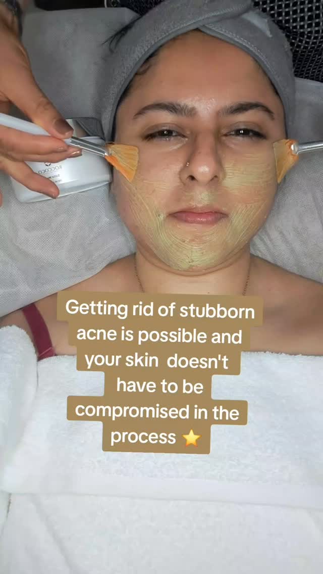 Skincare Tips for YOU 🫵
DID YOU KNOW ‼️⁉️
A skin condition can be improved just by following these skincare steps ?
🍎Using Customized Products
🍎Be consistent with your homecare routine
🍎Attend your in clinic appointments
🍎Reduce foods rich in animal fats
🍎Increaseing intake of fruits and vegetables !
If you found this helpful
PLEASE
Share with a friend & Save for later
@beautyblitzskin&Body
@beauty
.
.
.#skincaretips
#beautyblitzonqueen
#skincare101
#slackscreek
#skinclinicinlogan