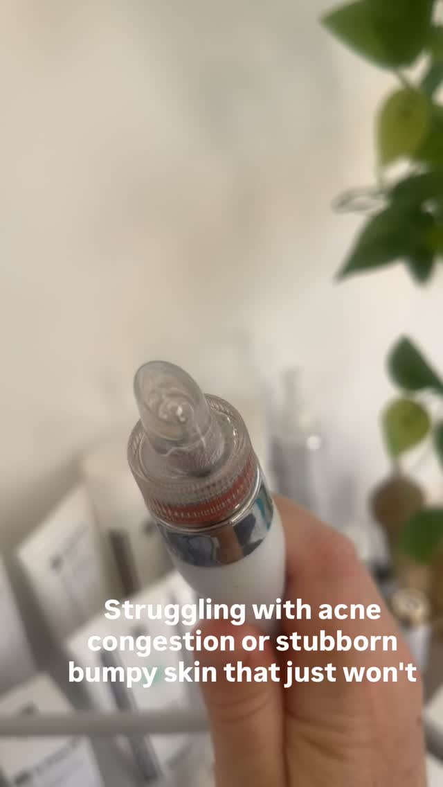 Pimples, spots, breakouts , black/white big small whatever we call them adult acne isn’t a desirable skin look
I have a signature extraction, hydrate and repair facial available to help clear and prevent breakouts. By preparing your skin for professional extractions you reduce the risk of scars and collagen damage from trauma .
DM to book or book via the link in bio which takes you to Fresher
Anna
❤️
#acne #extractions #leightonbuzzard #bedfordshireskinclinic #blackheads