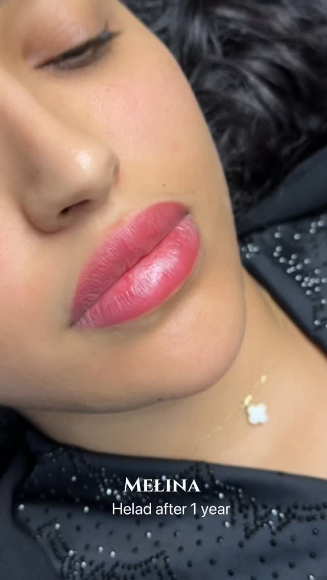 Beautiful Emirati client 🤍
You can see the healed Lip Blush result after one year, along with the immediate result of the annual touch-up session.
Lip Blush is a technique designed to enhance and add natural color to the lips. 🥰
You can choose your favorite shade.
Right after the procedure, the lips may appear similar to lipstick, but after the peeling stage, the result becomes much softer, more natural, and even more beautiful.
It has long-lasting results, however yearly or bi-yearly touch-ups can be done to refresh the color.
This procedure is performed using the latest techniques and high-quality needles. Even without numbing cream, the pain is very minimal and tolerable.
According to Dubai regulations, this treatment must only be performed inside a licensed clinic.
Please message us for consultation 🤍
#lipblushdubai #liptattoodubai #lipfillerdubai
