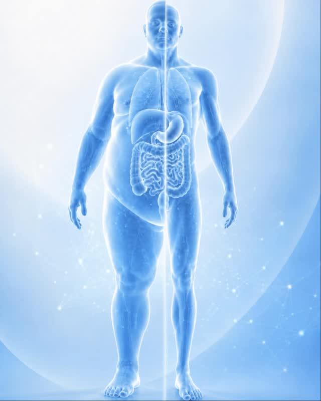¿Quieres bajar de peso de forma segura?
No empieces con una cirugía. Empieza con una valoración real.
Bajar de peso no debería tratarse de intentar una solución más.
Debería tratarse de encontrar el camino correcto para tu cuerpo, tu salud y tu historia clínica.
En SURGLAP, el proceso comienza con una evaluación completa para entender qué necesita cada paciente: estado metabólico, hábitos, antecedentes, objetivos y posibles enfermedades asociadas.
La experiencia médica es clave para definir si el tratamiento debe ser clínico, con balón gástrico, manga gástrica, bypass o cirugía metabólica.
Porque el verdadero cambio no ocurre solo en el quirófano.
Ocurre cuando existe un plan, seguimiento y decisiones tomadas con criterio.
Si quieres bajar de peso de la mejor manera, no busques solo perder kilos.
Busca recuperar salud con acompañamiento profesional.
Agenda una valoración y conoce el tratamiento adecuado para tu caso.
#CirugíaBariátrica #SaludMetabólica #BajarDePeso #MangaGástrica #cdmx