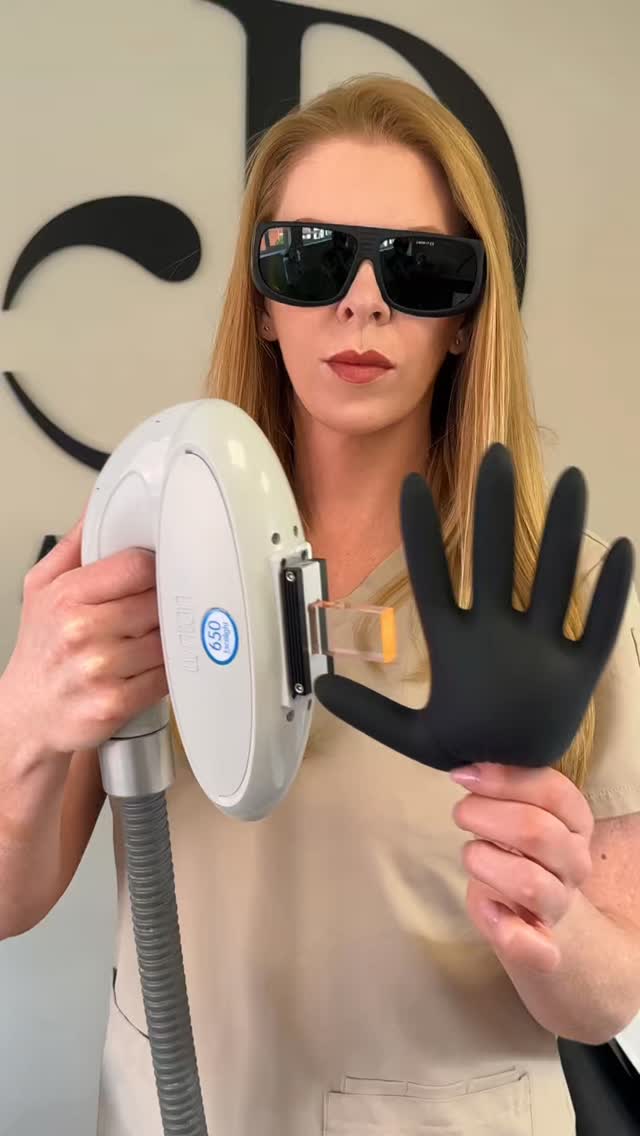 ✨ LASER HAIR REMOVAL & WHY HAIR COLOUR REALLY MATTERS ✨
Laser hair removal works by targeting the pigment (melanin) in the hair follicle. That’s why darker hair usually gets the best results — the laser can “see” it more easily.
✔ Dark brown & black hair = best response
✔ Coarse hair = usually easier to treat
✔ Blonde, red, grey & white hair = more difficult because there’s less pigment for the laser to target
This is also why multiple sessions are needed — hair grows in cycles, and the laser only works effectively during the active growth stage.
Modern laser technology can safely treat many different skin tones, but choosing the correct laser type and settings is essential for safe, effective results.
Not all hair types respond the same… and understanding the science behind it makes a huge difference. 💡
#laserhairremovalwarrington #hairremoval #laserclinicwarrington #aestheticswarrington #lasertreatment