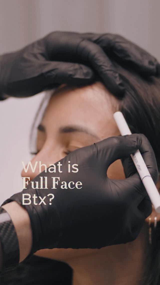 What Is Full Face Btx?
Btx applied to different areas of the face aims to soften expression lines, reduce muscle-related wrinkles, and achieve a more balanced facial expression.
This process may include customized techniques for the forehead, glabella, eye area, lip corners, chin, and even neck bands. Since each area has different needs, the treatment plan is evaluated individually.
The goal is not a frozen look, but a naturally refreshed and brighter appearance while keeping facial expressions intact.