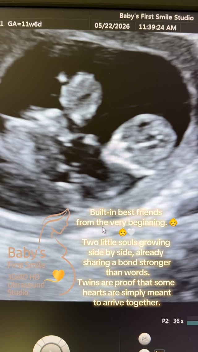 Baby’s First Smile Studio — where families meet their baby before birth. 💫
To book your appointment, please
call us at (832)792-8999
Or visit our website
www.babysfirstsmile.com
16350 Park Ten PI Ste. 213,
Houston, TX 77084
#babysfirstsmilestudio #houstonmom #ultrasound #twins #twinsofinstagram