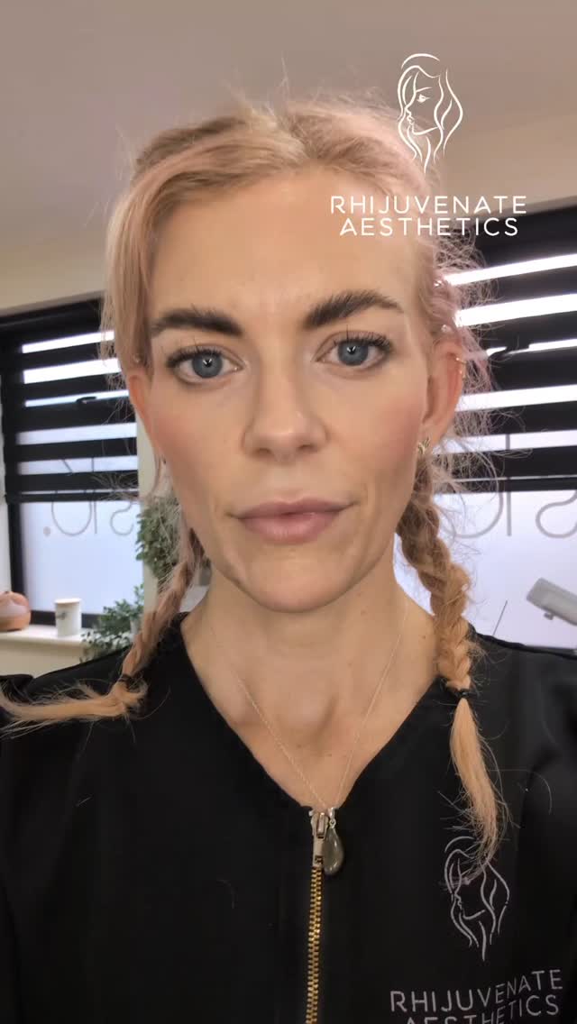 There's still time to secure your savings on the fantastic new Collagenex treatment. This has been a hit with some fantastic feedback from my clients!
DM to book your appointment!
š±07903078274
š©admin@rhijuvenateaesthetics.co.uk
šGU32 3EW
āØComplimentary consultations
š 19 years medical background
#aestheticsinjector #aestheticshampshire #petersfield #Collagenex #collagen