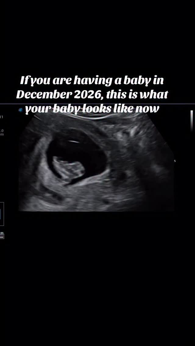 December 2026 mamas — your baby may be tiny right now, but they’re already growing so fast
There’s nothing sweeter than seeing your little one. Come make memories with us 💚
#2dultrasound #sweetpeaultrasound #electiveultrasoundstudio