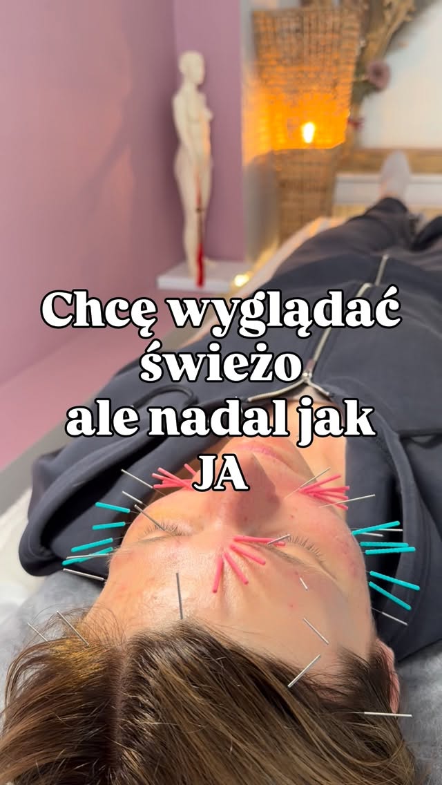 Akupunktura beauty to nie walka z twarzą.
To wspieranie jej naturalnych procesów. ✨
W świecie szybkich efektów, wypełniaczy i mocno ingerujących metod coraz więcej kobiet szuka czegoś bardziej subtelnego.
Czegoś, co nie zmienia rysów twarzy… ale przywraca jej świeżość, napięcie i blask.
I właśnie za to kocham akupunkturę kosmetyczną.
Bo zamiast „zamrażać” mimikę — pobudza krążenie, regenerację i pracę skóry od środka.
Naturalnie. Holistycznie. Z uważnością na całe ciało i emocje.
Co piękne — pierwsze efekty często widać bardzo szybko.
Moja pacjentka już po drugim zabiegu zauważyła wyraźne wygładzenie lwiej zmarszczki. A przed nami jeszcze kolejne spotkania i dalsza praca ze skórą. 🌿
Jeśli czujesz, że bliżej Ci do naturalnego wspierania skóry i pracy z ciałem w harmonii — zapraszam Cię na akupunkturę beauty twarzy do Bertha Holistic we Wrocławiu.