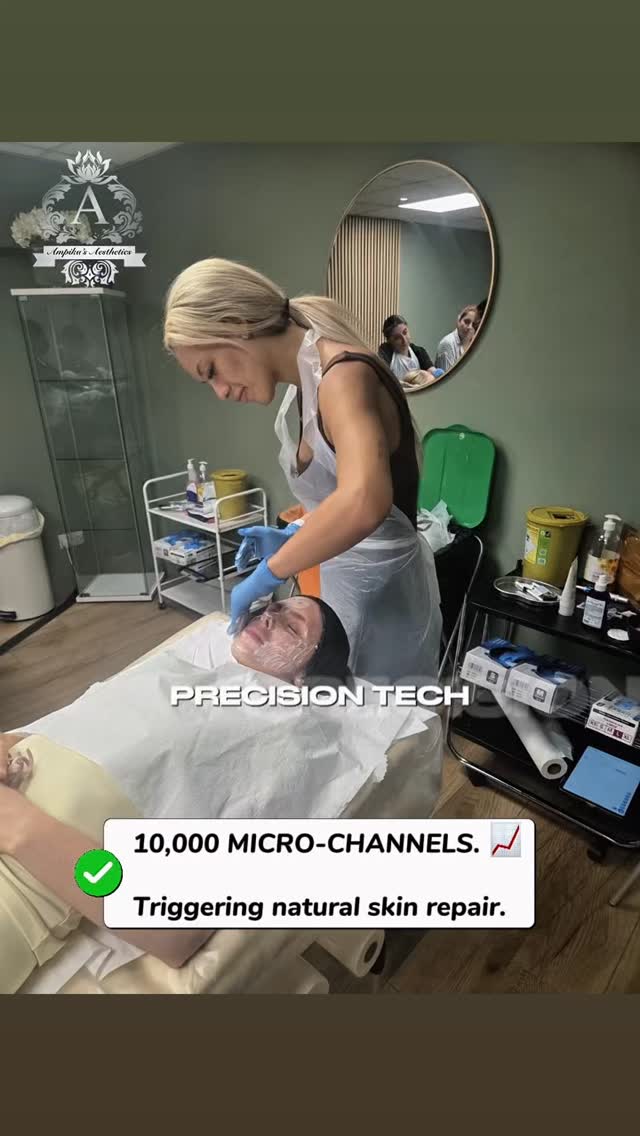Benefits of Microneedling ♥️♥️
Stimulates natural collagen and elastin production
Improves skin texture and smoothness
Reduces the appearance of fine lines and wrinkles
Helps fade acne scars and other mild scars
Minimizes enlarged pores
Improves skin firmness and elasticity
Evens out skin tone
Can help reduce pigmentation and sun damage
Enhances skin radiance and glow
Improves the appearance of stretch marks
Increases absorption of skincare products
Suitable for most skin types with minimal downtime
#microneedling#AmpikasAesthetics#aestheticstrainingacademy#facialtreatment