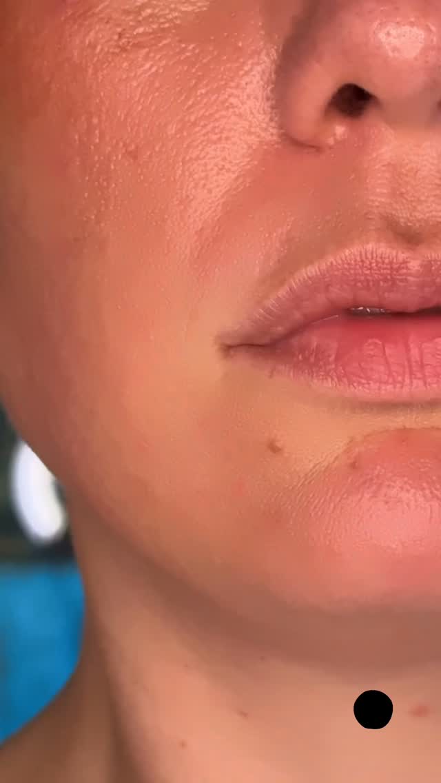 💕✨ Juicy lipsssss?
Disse to produkter fra Glo Skin vil sikre flotte, plumpe læber hele sommeren!
LIP REVIVAL er en avanceret behandling, der giver synlige resultater allerede fra første påføring! Kombinationen af AHA og BHA syrer eksfolierer nænsomt døde hudceller, så læberne straks føles glattere og mere ensartede. Samtidig hjælper den innovative formel med at reducere fine linjer og tilfører intens fugt. 💦
Pris: 199kr
CONDITIONING LIPGLOSS er en langtidsholdbar, plejende lipgloss i en højglans, ikke-klæbende finish, som er fyldt med hyaluronsyre og antioxidanter. Den beskytter, mens den tilføjer en gennemsigtig, let glaseret farve. Den dufter friskt af pebermynte der forfrisker sanserne. 💖
Pris: 179kr
Køb dem på www.lajolie.dk, eller kom forbi vores butik Valby Langgade 30a! 🫶🏼
Har du spørgsmål? Smid os en DM. 💓
#lajoliedk #heledig