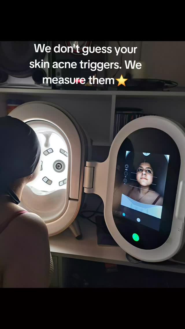 Are you treating treating t he symptoms of your acne o4 the root cause?
Acne is a multi-layerd inflammatory condition.
Treating it successfully requires more than just surface- level observation.
Using products and random treatments without a clinical assessment often leads to skin barrier damage.
Our digital Skin Analizer allows us to look beneath the stratum corneum.
Things like :
🌾Surface inflamation
🌾Bacterial excretions
🌾Sebum production
🌾 Post Inflammatory pigmentation.
Doing this help us eliminate the guees work and formulate a targeted plan.
To clear your your acne safely and restore your skin barrier function.
Your Skincare Plans often consist of:
Gentle peels , Led Light Therapy, Oxygen Therapy Cold plasma therapy and infrared .
invest in clinical accuracy not tryal & error .
Appointments via DM
@beautyblitzonqueen@panaroma_shots_byher
.
.
.
#acnetreatment
#clinicalskincare
#acnesolusions
#acnecongestion
#skinassessment