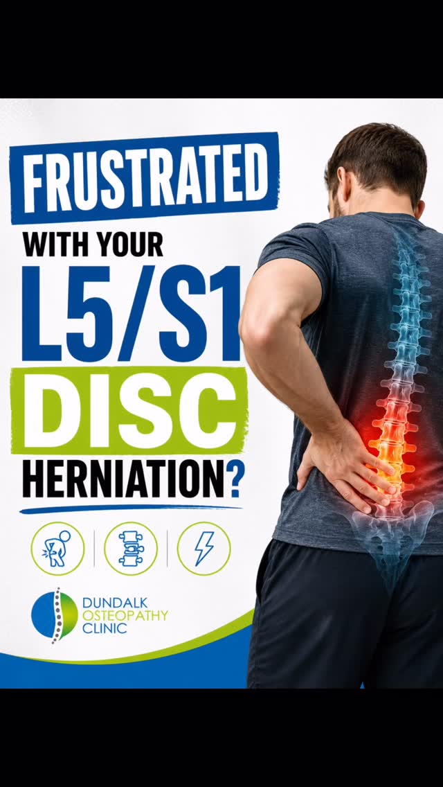 Are you suffering from an L5/S1 disc herniation and getting frustrated?
One of the biggest mistakes I see is people expecting pain to settle without rebuilding movement, confidence and strength.
Recovery is rarely straightforward — but most people improve with the right approach.
Questions? Drop them below 👇 #backpain #sciatica #sciaticarelief #dundalkosteopathyclinic #dundalksportsmedicine