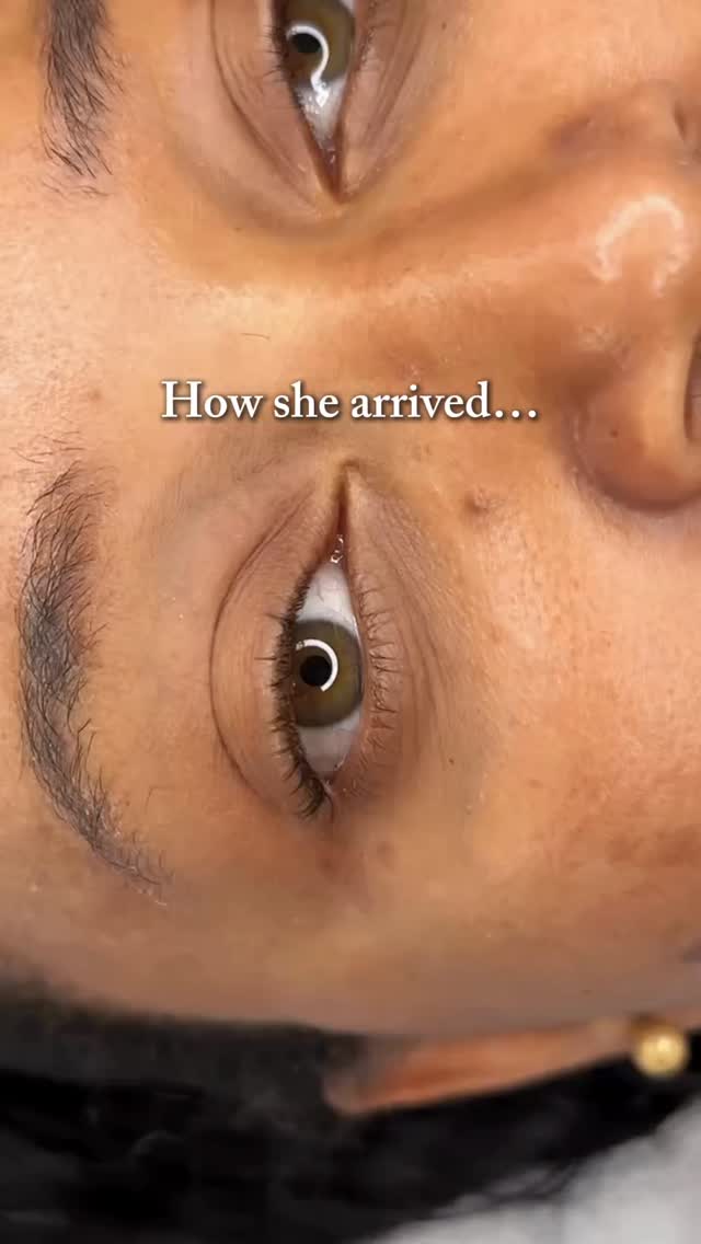 A lash line tattoo is one of the most subtle permanent makeup treatments, yet the transformation is noticeable every single day ✨
🤍 No harsh eyeliner
🤍 No smudging throughout the day
🤍 No extra time getting ready in the morning
📩 DM me to learn if a lash line enhancement is right for you.
____________________________________________________
Permanent Makeup Services, Tattoo Removal & Carbon Laser Facial
⬆️Book apt with the link in bio
✨Free Consultation available
📍Oshawa, Ontario
✉️ browsbyieva@gmail.com
📱 +1 416-804-6749
Website: permanentbeautybyieva.com
#oshawapmu #whitbypmu #oshawapermanentmakeup #oshawaeyelinertattoo #oshawatattoo