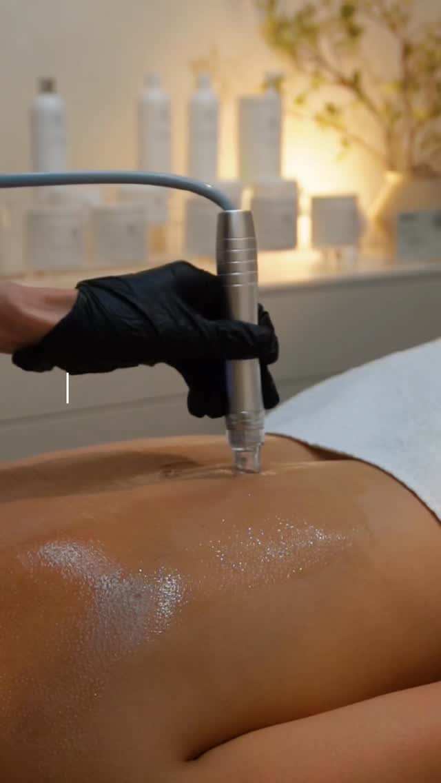 Your back deserves skincare too. ✨
Deep-cleaning hydrodermabrasion, pore-clearing extractions, and a cooling O2 Calming Gel to leave skin feeling fresh, soothed, and revitalized.
Product used:
@lemieux O2 Calming Gel
Website🔗www.ricozybeauty.com
Contact 📩 info@ricozybeauty.com
Location📍300 E Colorado Blvd, Unit 241, Studio 409,
Pasadena CA 91101 @salonrepublic
#skincare #facial #backfacial #lemieux #hydrodermabrasion